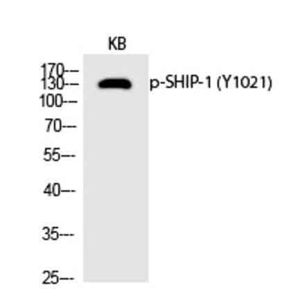 Western blot - SHIP-1 (Phospho-Tyr1021) Polyclonal Antibody from Signalway Antibody (12235) - Antibodies.com