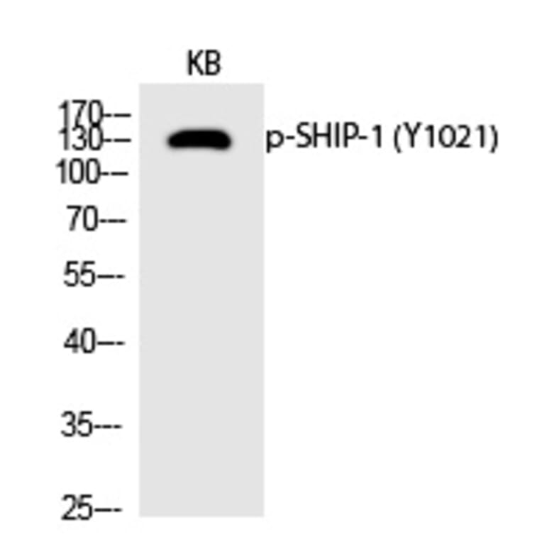 Western blot - SHIP-1 (Phospho-Tyr1021) Polyclonal Antibody from Signalway Antibody (12235) - Antibodies.com