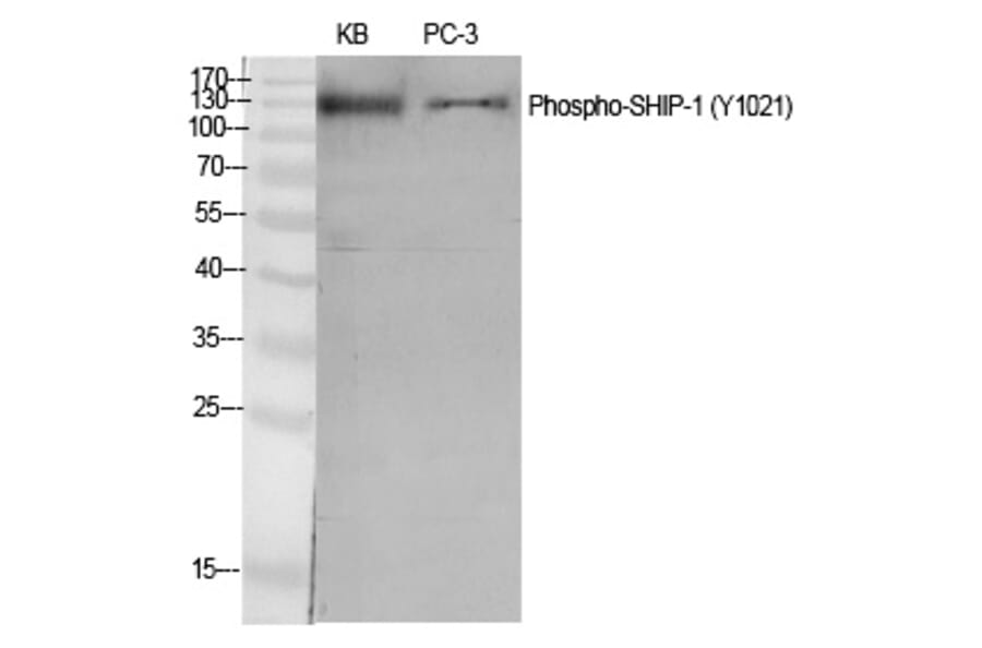 Western blot - SHIP-1 (Phospho-Tyr1021) Polyclonal Antibody from Signalway Antibody (12235) - Antibodies.com