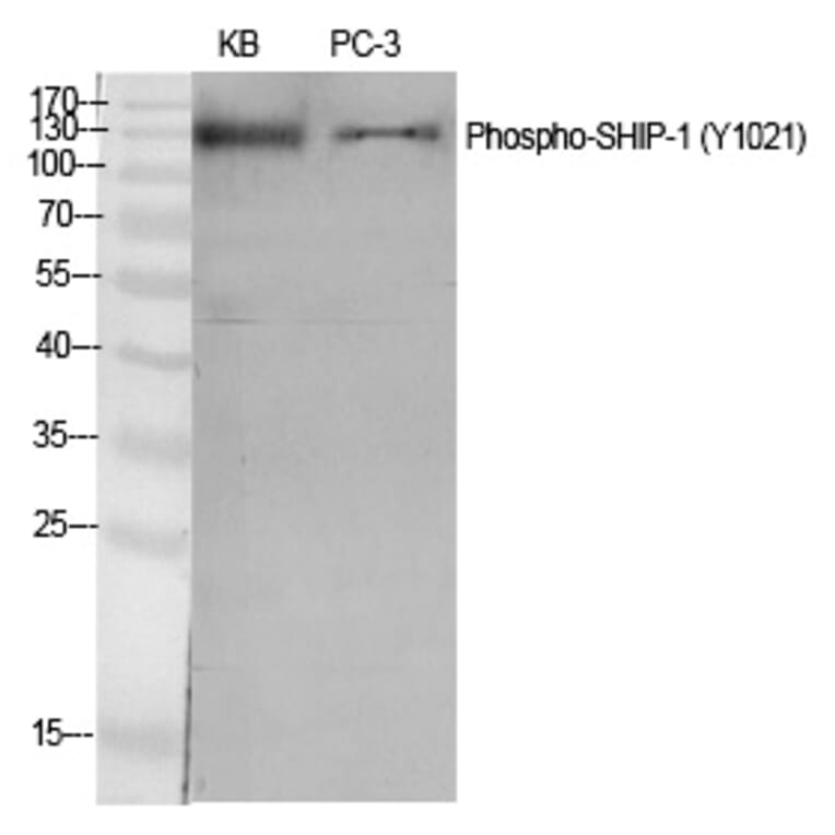 Western blot - SHIP-1 (Phospho-Tyr1021) Polyclonal Antibody from Signalway Antibody (12235) - Antibodies.com