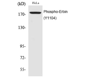 Western blot - Erbin (Phospho-Tyr1104) Polyclonal Antibody from Signalway Antibody (12194) - Antibodies.com