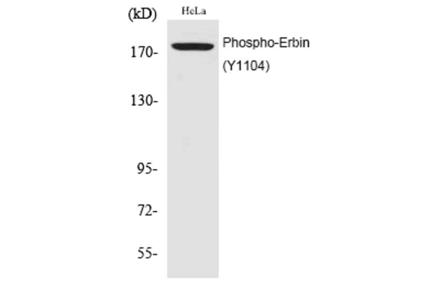 Western blot - Erbin (Phospho-Tyr1104) Polyclonal Antibody from Signalway Antibody (12194) - Antibodies.com