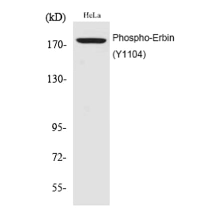 Western blot - Erbin (Phospho-Tyr1104) Polyclonal Antibody from Signalway Antibody (12194) - Antibodies.com