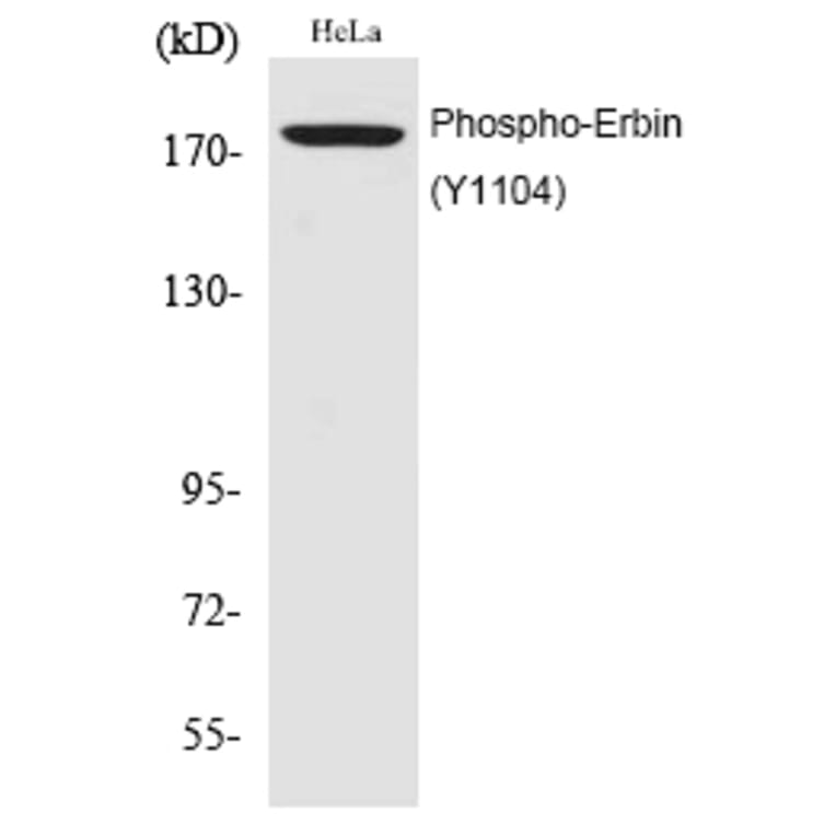 Western blot - Erbin (Phospho-Tyr1104) Polyclonal Antibody from Signalway Antibody (12194) - Antibodies.com