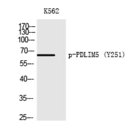 Western blot - PDLIM5 (Phospho-Tyr251) Polyclonal Antibody from Signalway Antibody (12217) - Antibodies.com