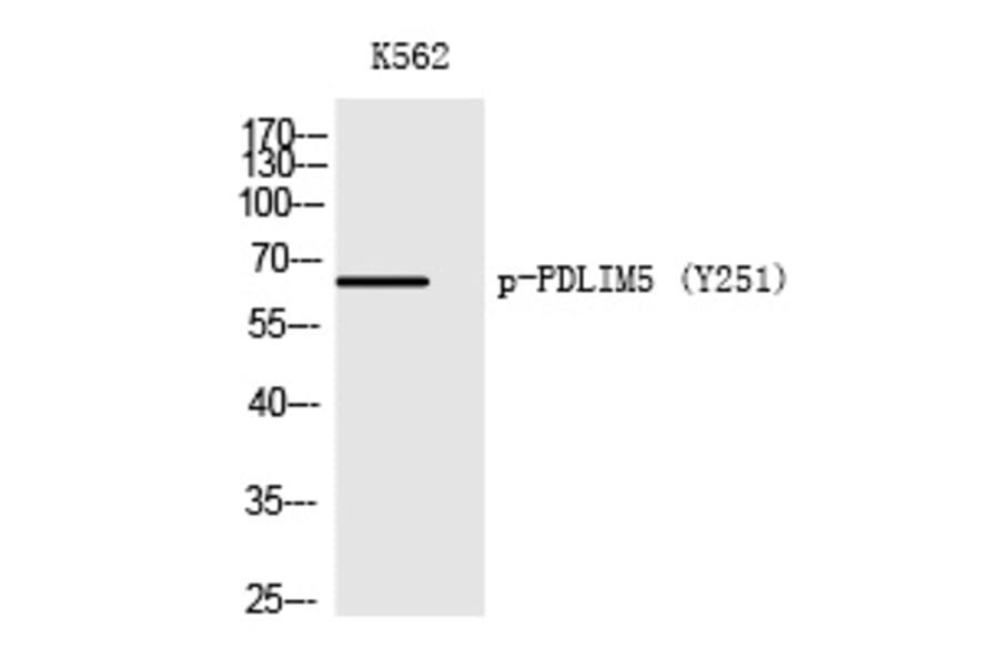 Western blot - PDLIM5 (Phospho-Tyr251) Polyclonal Antibody from Signalway Antibody (12217) - Antibodies.com