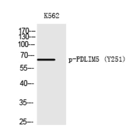 Western blot - PDLIM5 (Phospho-Tyr251) Polyclonal Antibody from Signalway Antibody (12217) - Antibodies.com