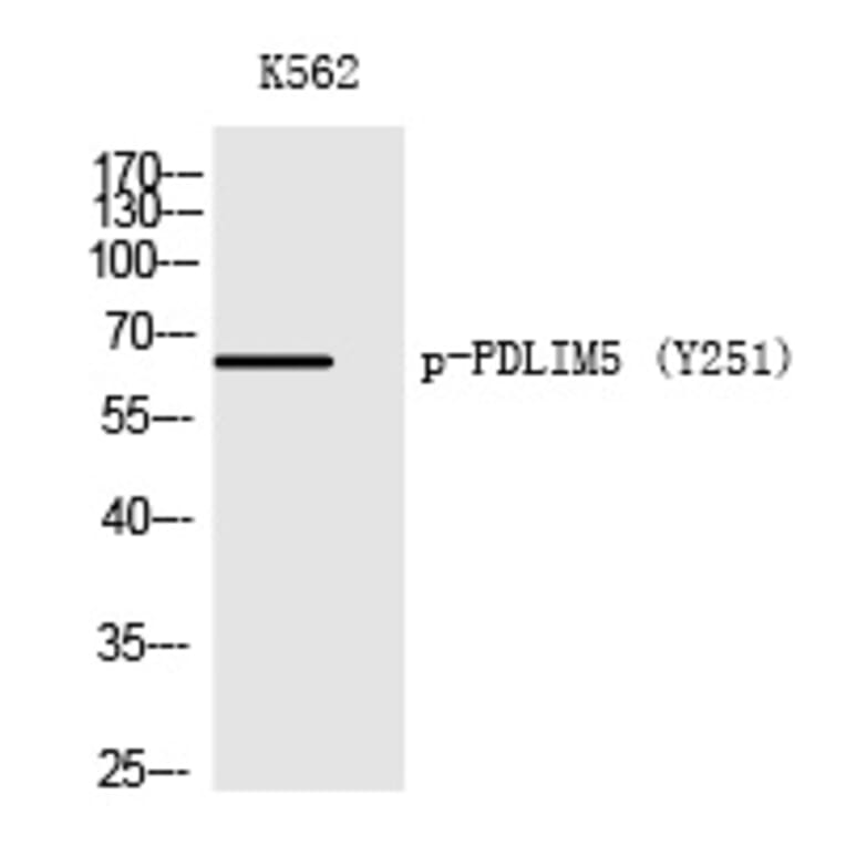 Western blot - PDLIM5 (Phospho-Tyr251) Polyclonal Antibody from Signalway Antibody (12217) - Antibodies.com