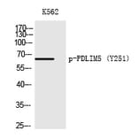Western blot - PDLIM5 (Phospho-Tyr251) Polyclonal Antibody from Signalway Antibody (12217) - Antibodies.com