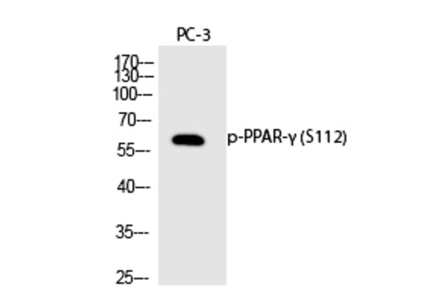 Western blot - PPAR-γ (Phospho-Ser112) Polyclonal Antibody from Signalway Antibody (12231) - Antibodies.com