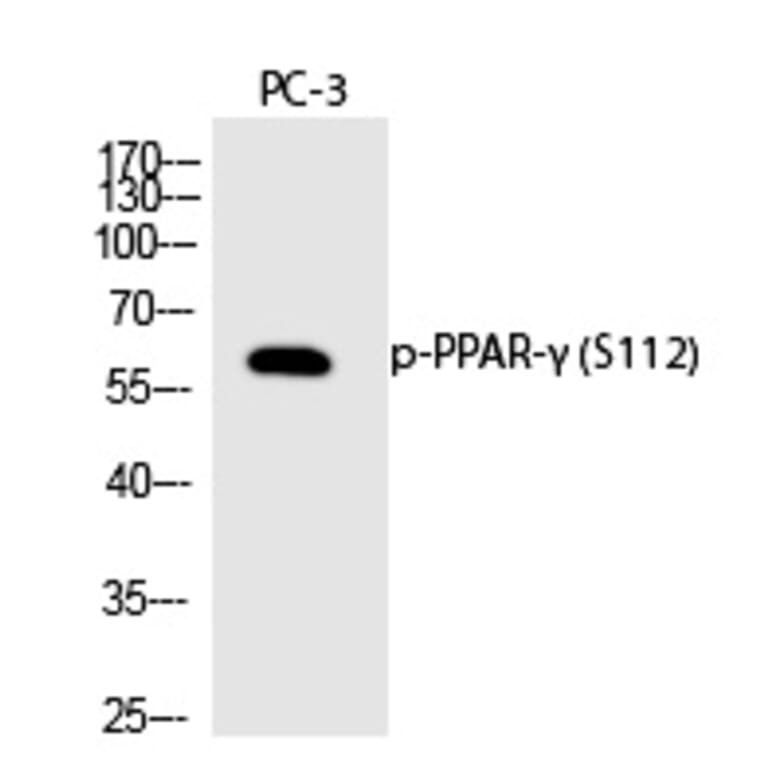 Western blot - PPAR-γ (Phospho-Ser112) Polyclonal Antibody from Signalway Antibody (12231) - Antibodies.com