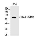 Western blot - PPAR-γ (Phospho-Ser112) Polyclonal Antibody from Signalway Antibody (12231) - Antibodies.com
