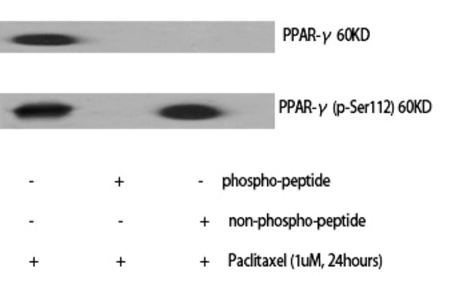Western blot - PPAR-γ (Phospho-Ser112) Polyclonal Antibody from Signalway Antibody (12231) - Antibodies.com