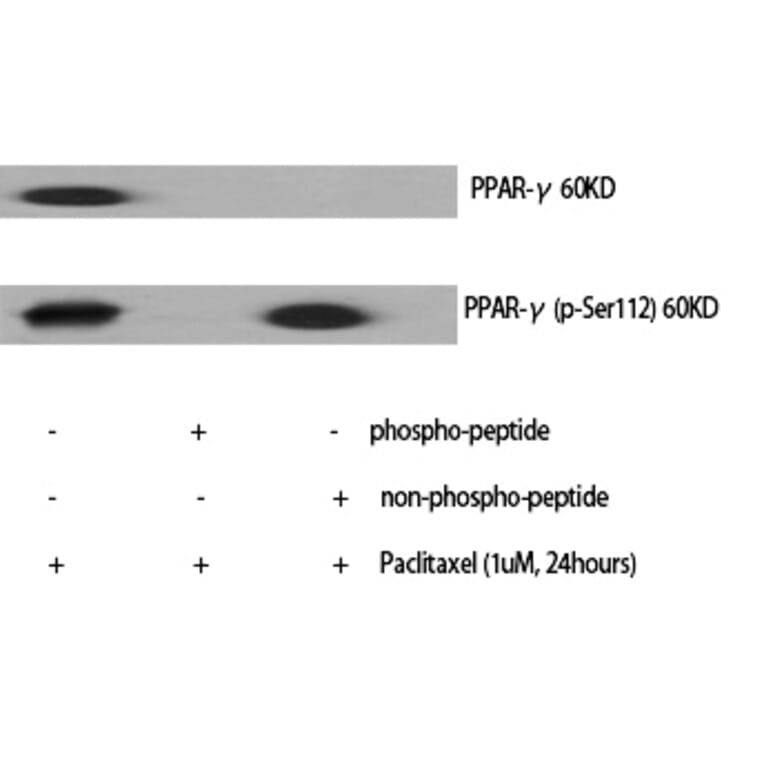 Western blot - PPAR-γ (Phospho-Ser112) Polyclonal Antibody from Signalway Antibody (12231) - Antibodies.com