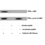 Western blot - PPAR-γ (Phospho-Ser112) Polyclonal Antibody from Signalway Antibody (12231) - Antibodies.com