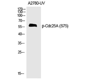 Western blot - Cdc25A (Phospho-Ser75) Polyclonal Antibody from Signalway Antibody (12189) - Antibodies.com