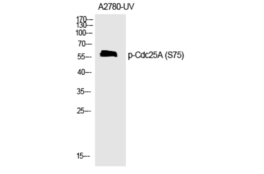 Western blot - Cdc25A (Phospho-Ser75) Polyclonal Antibody from Signalway Antibody (12189) - Antibodies.com