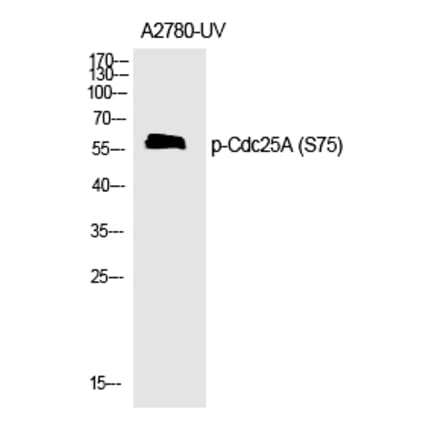 Western blot - Cdc25A (Phospho-Ser75) Polyclonal Antibody from Signalway Antibody (12189) - Antibodies.com