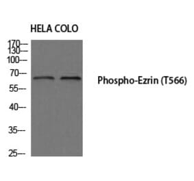 Western blot - Ezrin (Phospho-Thr566) Polyclonal Antibody from Signalway Antibody (12195) - Antibodies.com