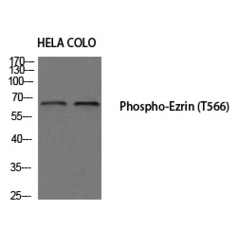 Western blot - Ezrin (Phospho-Thr566) Polyclonal Antibody from Signalway Antibody (12195) - Antibodies.com