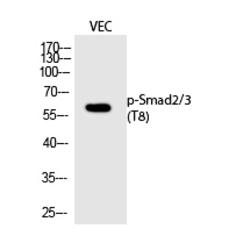 Western blot - Smad2/3 (Phospho-Thr8) Polyclonal Antibody from Signalway Antibody (12241) - Antibodies.com