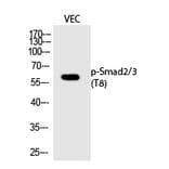 Western blot - Smad2/3 (Phospho-Thr8) Polyclonal Antibody from Signalway Antibody (12241) - Antibodies.com