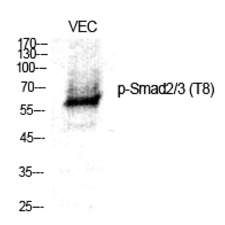 Western blot - Smad2/3 (Phospho-Thr8) Polyclonal Antibody from Signalway Antibody (12241) - Antibodies.com