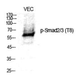Western blot - Smad2/3 (Phospho-Thr8) Polyclonal Antibody from Signalway Antibody (12241) - Antibodies.com