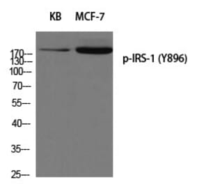 Western blot - IRS-1 (Phospho-Tyr896) Polyclonal Antibody from Signalway Antibody (12258) - Antibodies.com