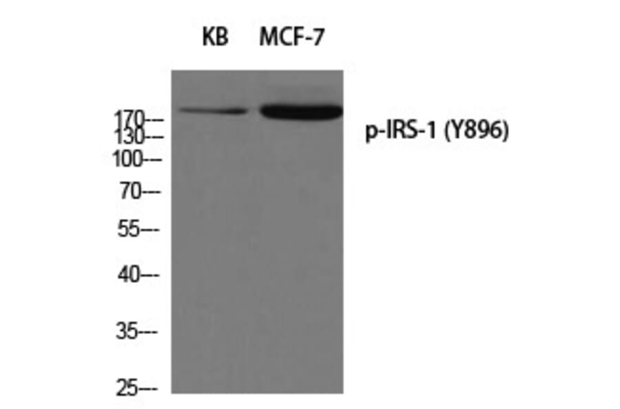 Western blot - IRS-1 (Phospho-Tyr896) Polyclonal Antibody from Signalway Antibody (12258) - Antibodies.com