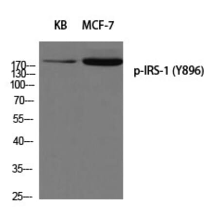 Western blot - IRS-1 (Phospho-Tyr896) Polyclonal Antibody from Signalway Antibody (12258) - Antibodies.com