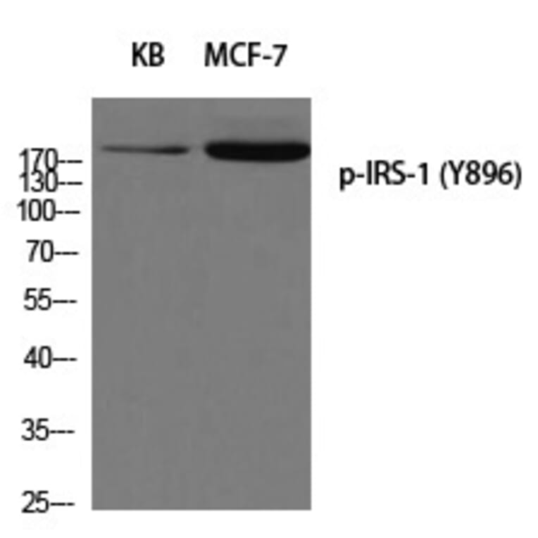 Western blot - IRS-1 (Phospho-Tyr896) Polyclonal Antibody from Signalway Antibody (12258) - Antibodies.com