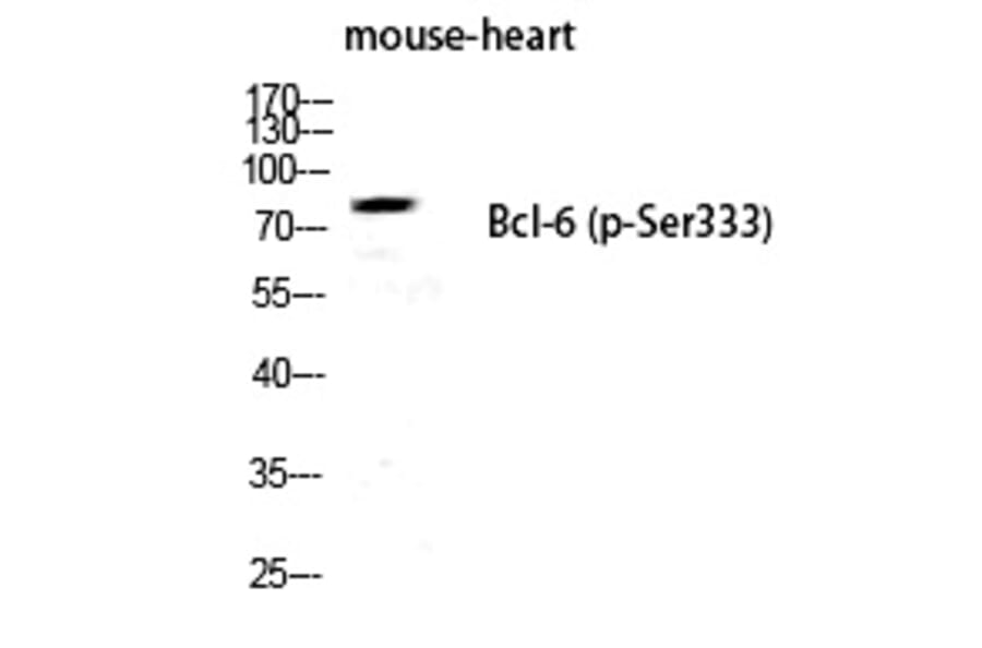 Western blot - Bcl-6 (Phospho-Ser333) Polyclonal Antibody from Signalway Antibody (12261) - Antibodies.com