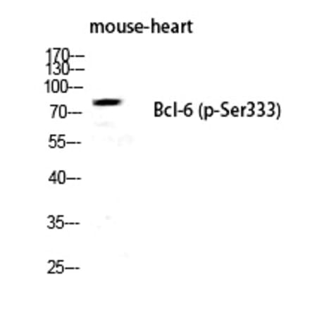 Western blot - Bcl-6 (Phospho-Ser333) Polyclonal Antibody from Signalway Antibody (12261) - Antibodies.com