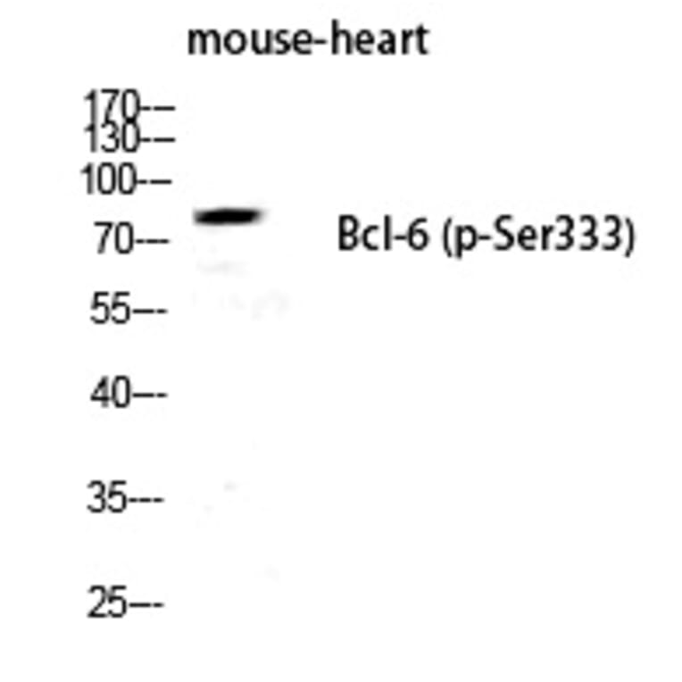 Western blot - Bcl-6 (Phospho-Ser333) Polyclonal Antibody from Signalway Antibody (12261) - Antibodies.com