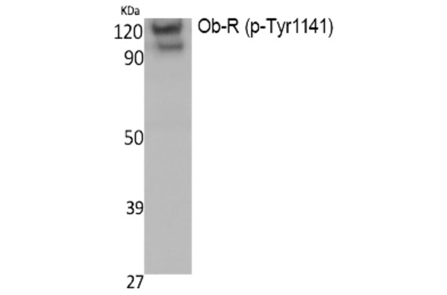 Western blot - Ob-R (Phospho-Tyr1141) Polyclonal Antibody from Signalway Antibody (12391) - Antibodies.com