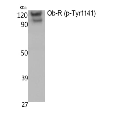 Western blot - Ob-R (Phospho-Tyr1141) Polyclonal Antibody from Signalway Antibody (12391) - Antibodies.com