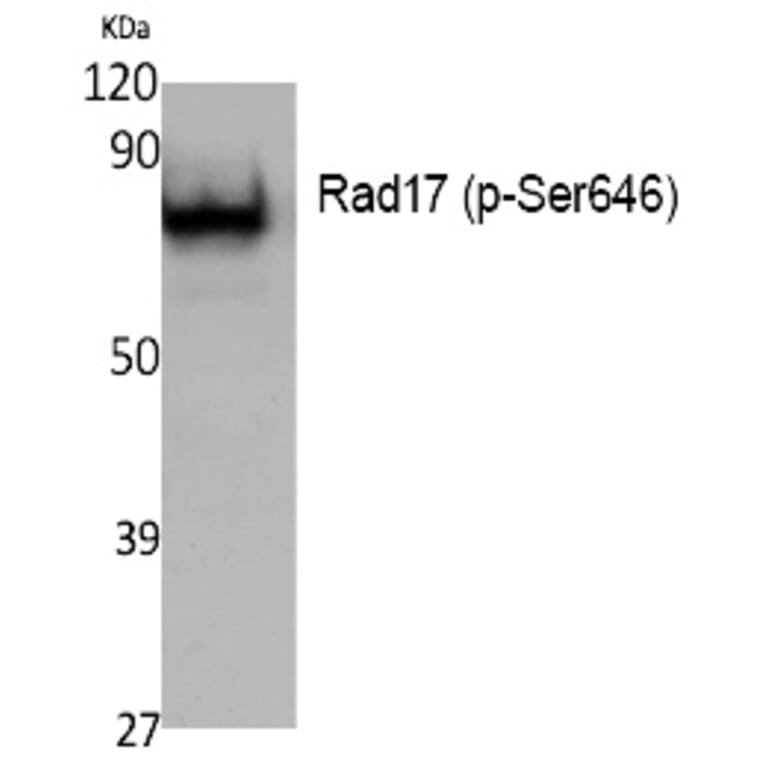 Western blot - Rad17 (Phospho-Ser646) Polyclonal Antibody from Signalway Antibody (12394) - Antibodies.com