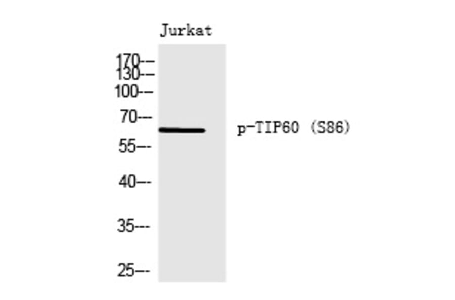 Western blot - TIP60 (Phospho-Ser86) Polyclonal Antibody from Signalway Antibody (12237) - Antibodies.com