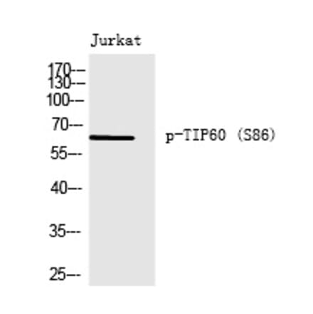 Western blot - TIP60 (Phospho-Ser86) Polyclonal Antibody from Signalway Antibody (12237) - Antibodies.com