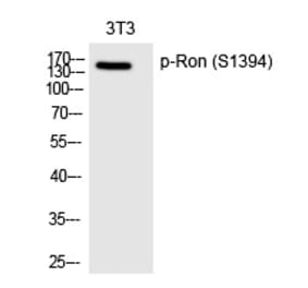 Western blot - Ron (Phospho-Ser1394) Polyclonal Antibody from Signalway Antibody (12239) - Antibodies.com