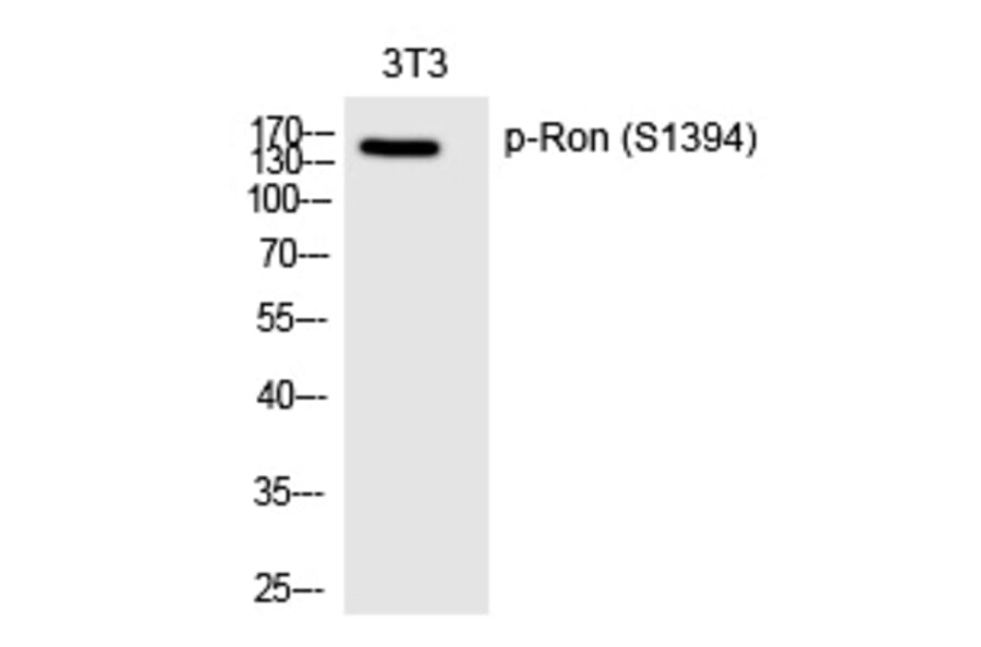 Western blot - Ron (Phospho-Ser1394) Polyclonal Antibody from Signalway Antibody (12239) - Antibodies.com