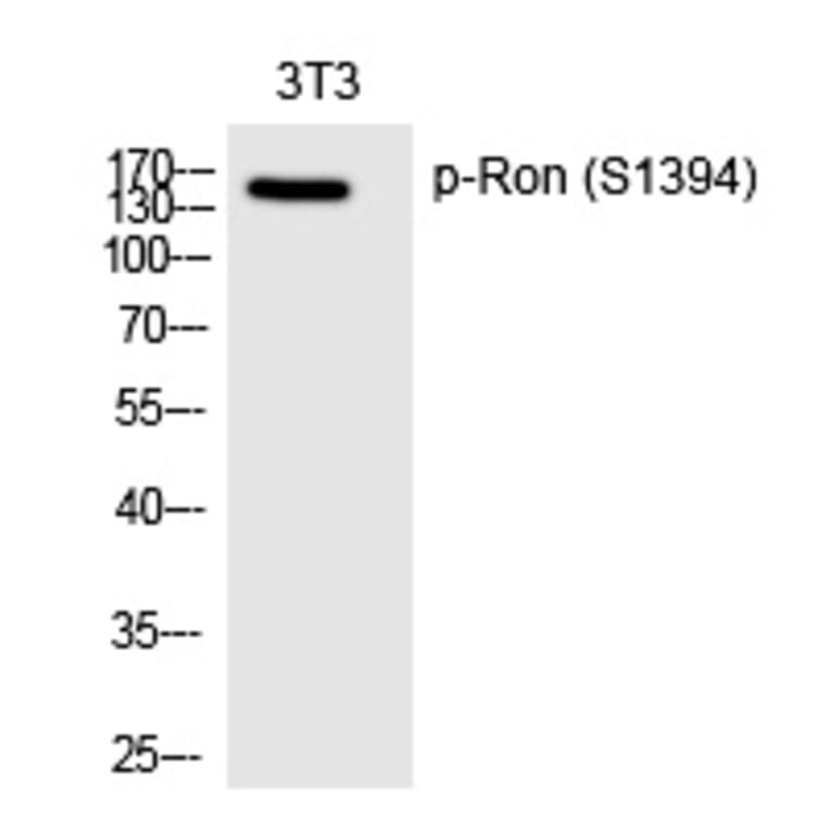 Western blot - Ron (Phospho-Ser1394) Polyclonal Antibody from Signalway Antibody (12239) - Antibodies.com