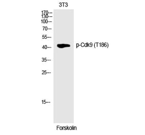 Western blot - Cdk9 (Phospho-Thr186) Polyclonal Antibody from Signalway Antibody (12242) - Antibodies.com