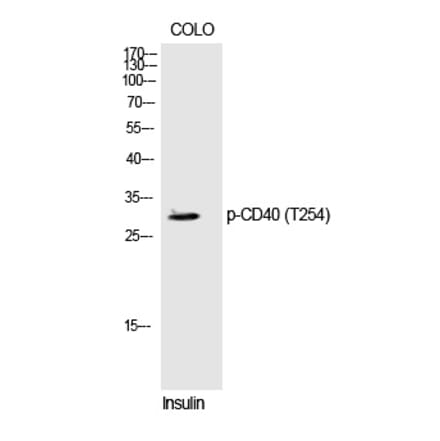 Western blot - CD40 (Phospho-Thr254) Polyclonal Antibody from Signalway Antibody (12246) - Antibodies.com