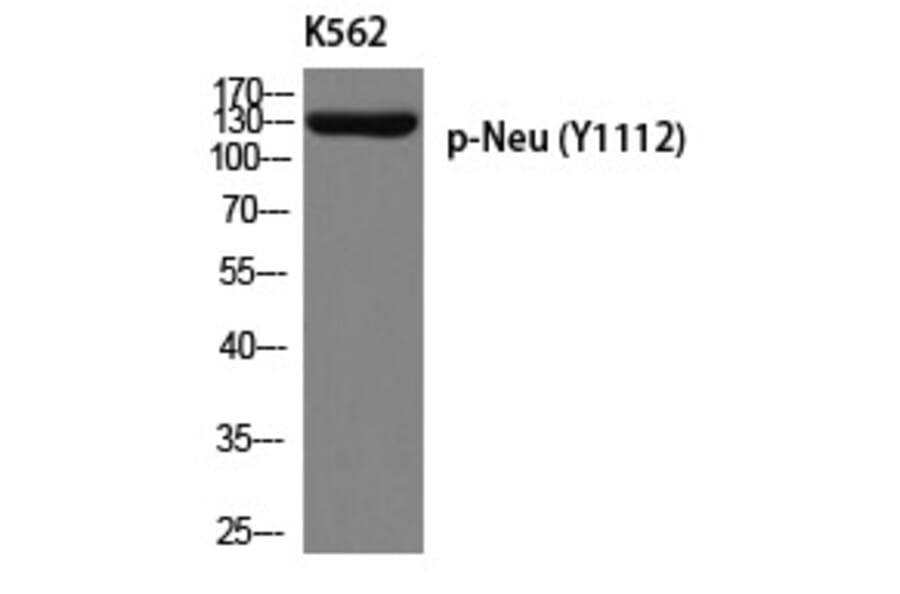 Western blot - Neu (Phospho-Tyr1112) Polyclonal Antibody from Signalway Antibody (12253) - Antibodies.com