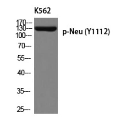 Western blot - Neu (Phospho-Tyr1112) Polyclonal Antibody from Signalway Antibody (12253) - Antibodies.com