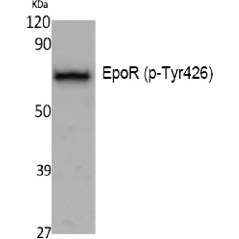 Western blot - EpoR (Phospho-Tyr426) Polyclonal Antibody from Signalway Antibody (12396) - Antibodies.com