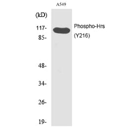 Western blot - Hrs (Phospho-Tyr216) Polyclonal Antibody from Signalway Antibody (12202) - Antibodies.com