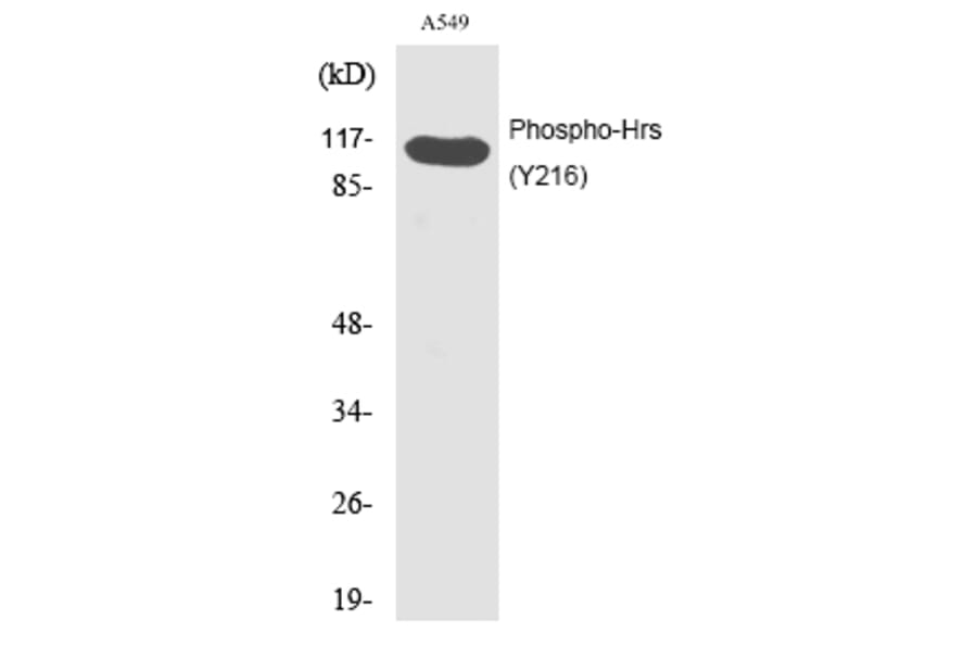 Western blot - Hrs (Phospho-Tyr216) Polyclonal Antibody from Signalway Antibody (12202) - Antibodies.com